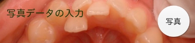 写真データの入力